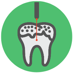 LASER DENTISTRY