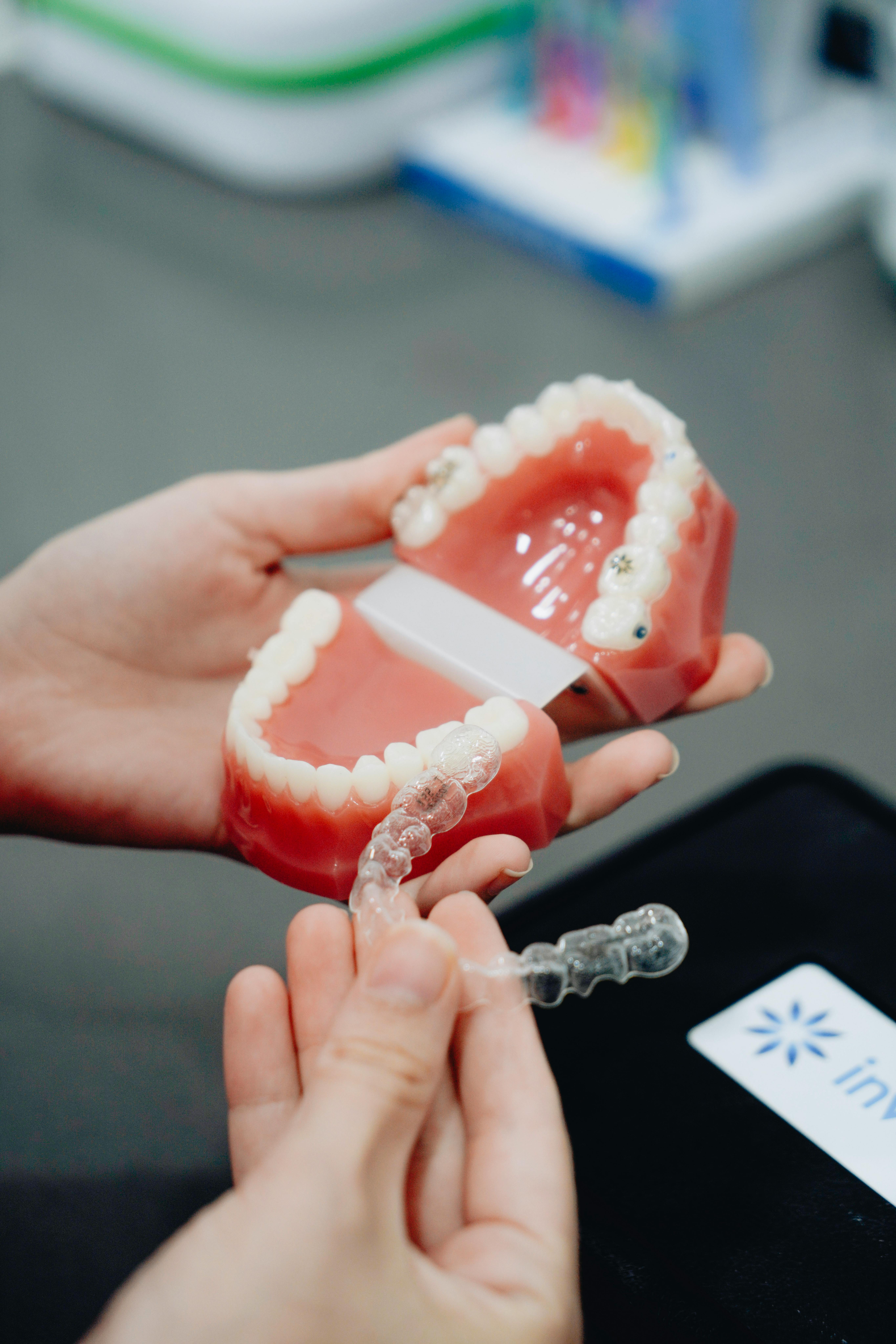 Dental Aligners in Gurgaon (2)